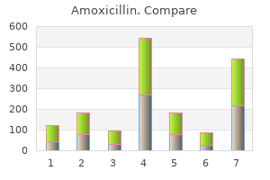 safe 250mg amoxicillin