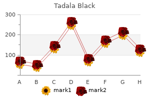 cheap tadala black 80mg on line