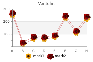 order generic ventolin on-line