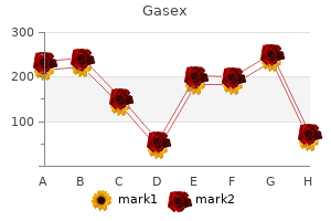 order 100caps gasex mastercard