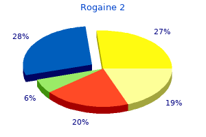 generic rogaine 2 60ml without prescription