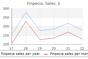 purchase finpecia 1mg line