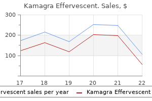 order kamagra effervescent 100 mg without prescription