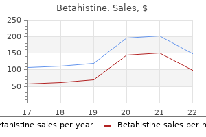 purchase betahistine 16mg fast delivery