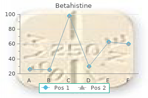 effective 16 mg betahistine