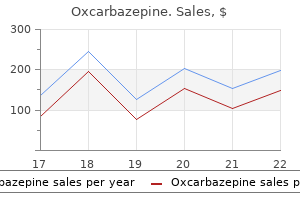 buy cheap oxcarbazepine 300 mg online
