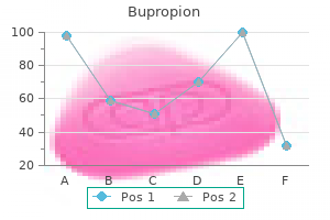 generic 150 mg bupropion with amex