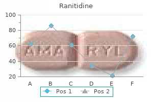 order ranitidine 150 mg on-line