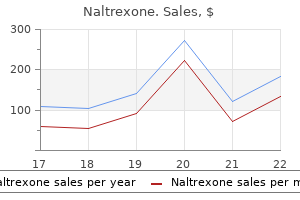 buy 50 mg naltrexone amex