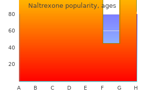 cheap naltrexone 50 mg online